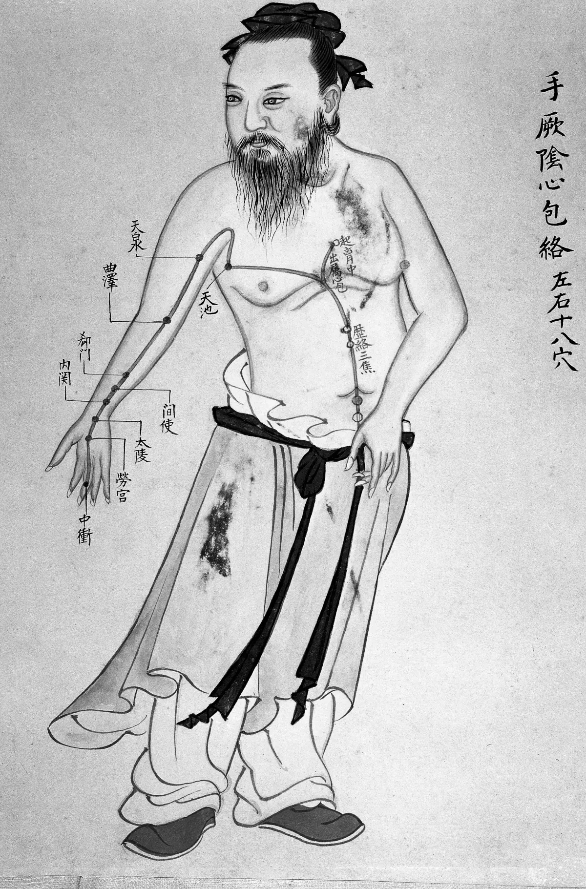18th century Chinese acupuncture chart showing meridian pathways and acupoints