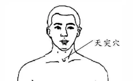 CV22 acupressure point in the suprasternal notch