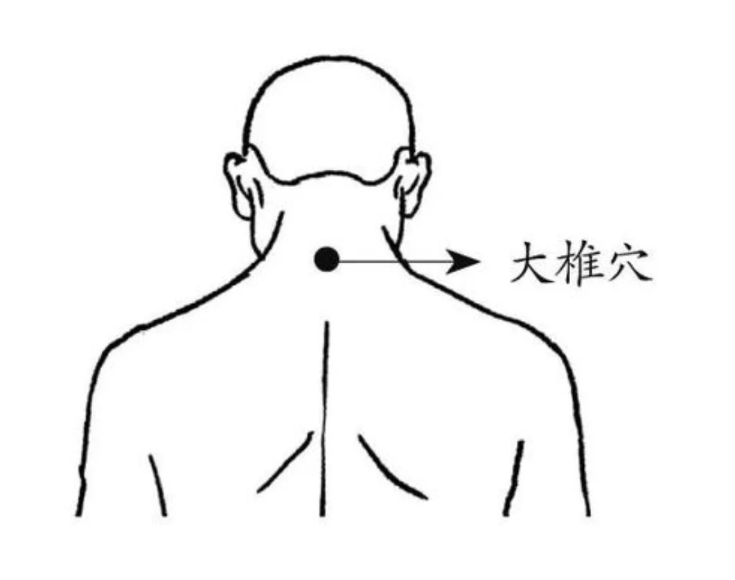 GV14 acupressure point below the seventh cervical vertebra
