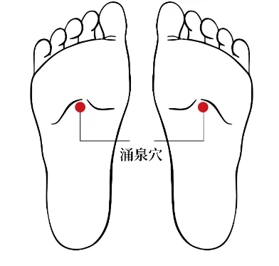 KI1 acupressure point on the sole of the foot