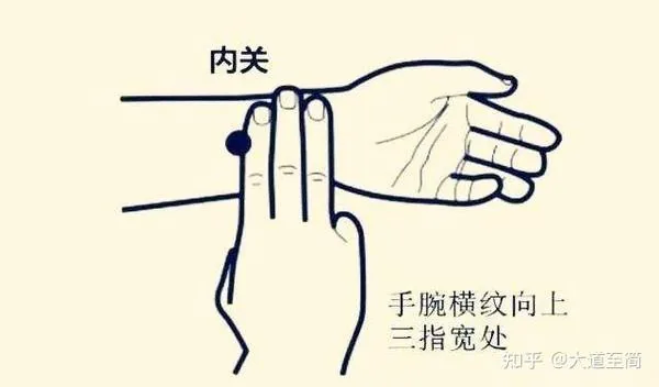 PC6 Neiguan acupressure point on the inner forearm
